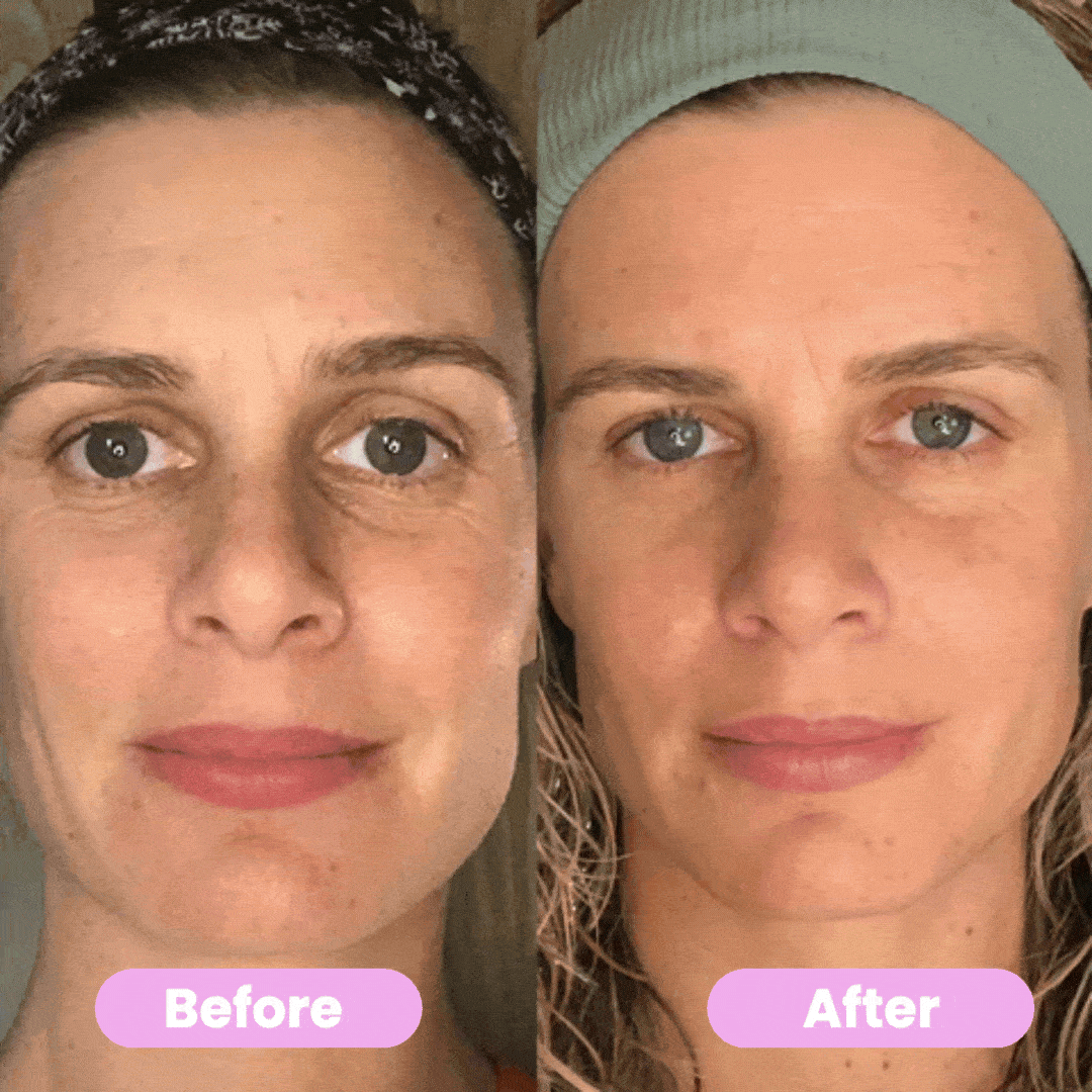 Noura Beauty Facelift Wand